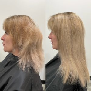 fusion before after from Kristen