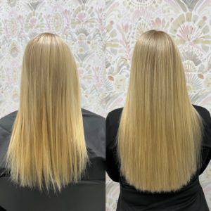 fusion before after from Kristen 8