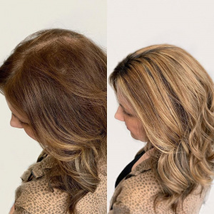 hair-topper-for-thinning-hair-VA-Beach